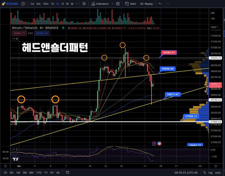 헤드앤숄더패턴