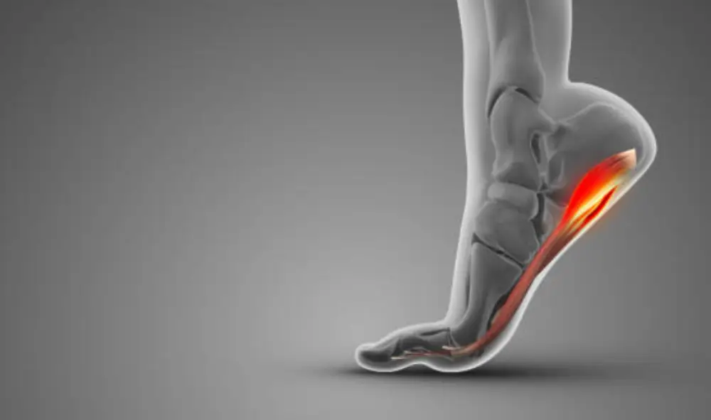 족저근막염 위치