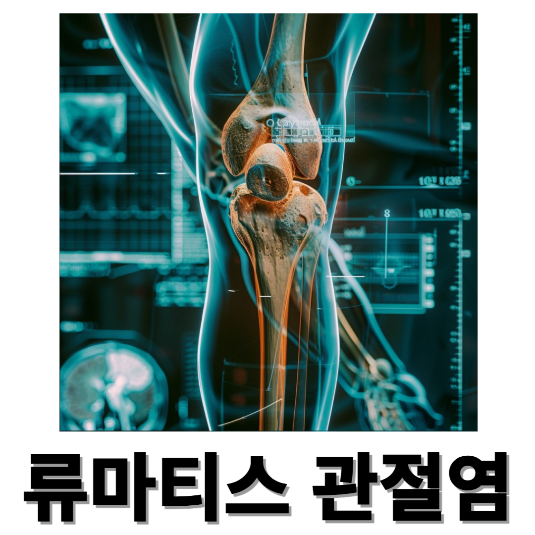 류마티스 관절염과 관련된 사진입니다.