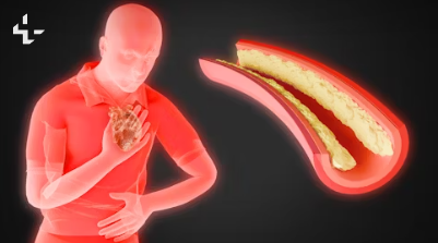 몸속 안 좋은 염증