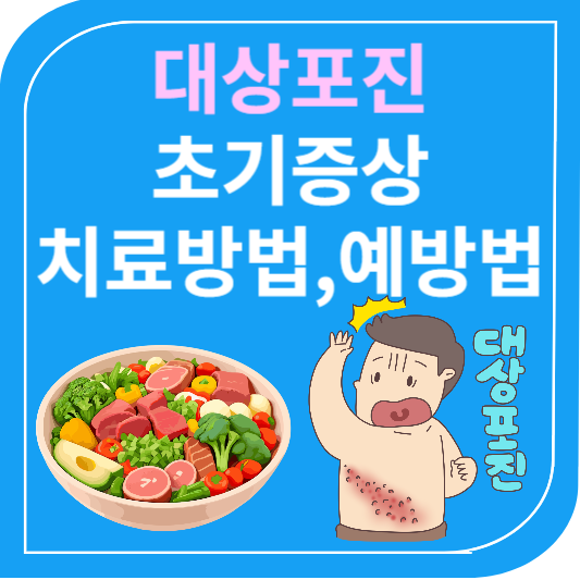 대상포진 초기증상 치료방법 예방법