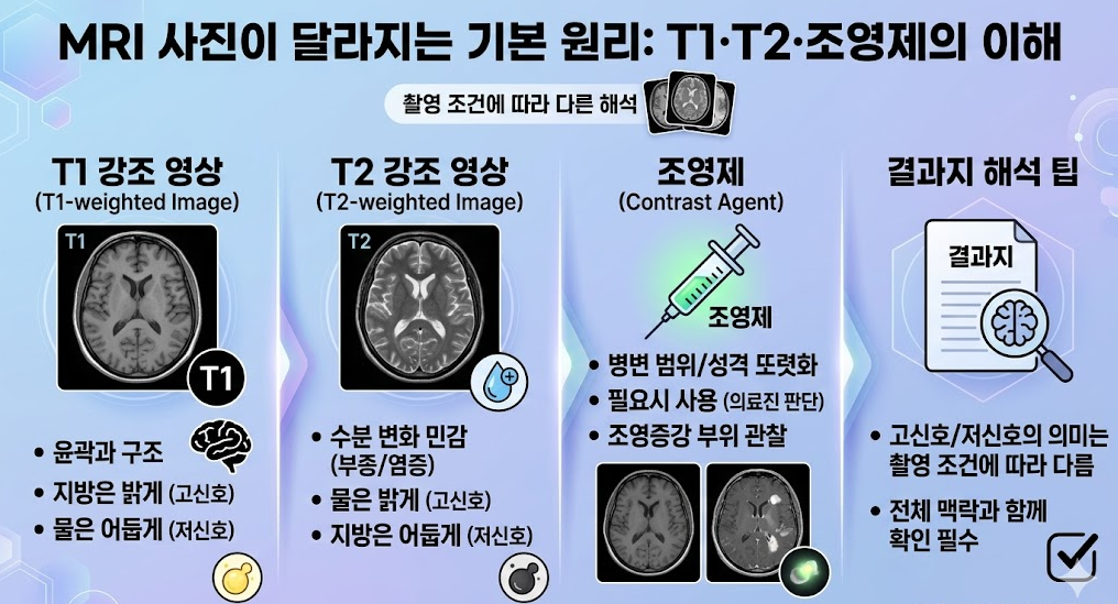 MRI T1 T2 조영제 영상 차이와 기본 원리 설명 이미지