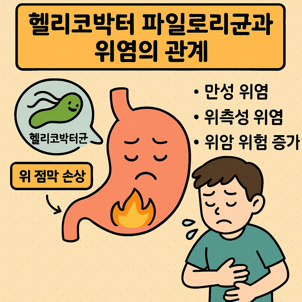 헬리코박터균 감염 증상과 위염 예방법 이미지