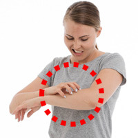 대상포진-때문에-팔이-가려운-여성-사진