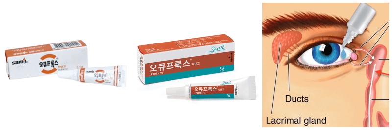 오큐프록스 안연고, 안연고 넣는법 사진