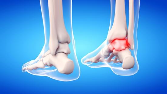 발목 통증을 유발하는 질환: 원인과 치료 방법