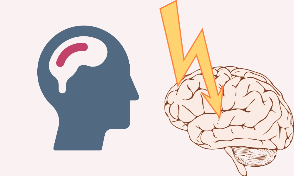 뇌졸증 초기증상
