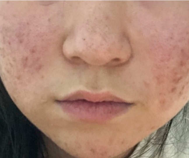 비브셀 힐스카겔 후기