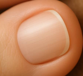 발톱 검은색 세로줄, 단순 멍일까? 흑색종일까?