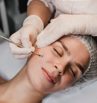 전문가의 도움으로 블랙헤드 제거