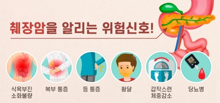 췌장암을 알리는 신호들
