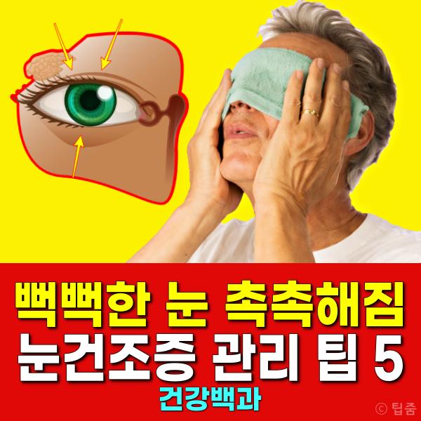 눈건조증 치료 관리 팁 안과전문의 추천