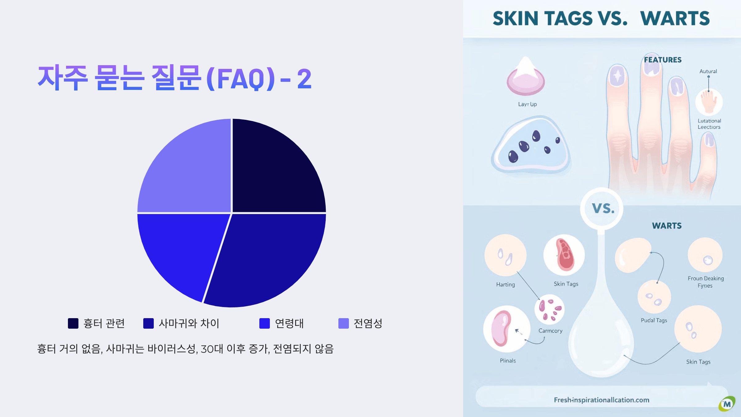쥐젖과 관련된 사진입니다.