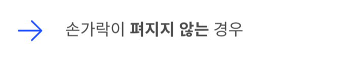 방아쇠 수지 증후군