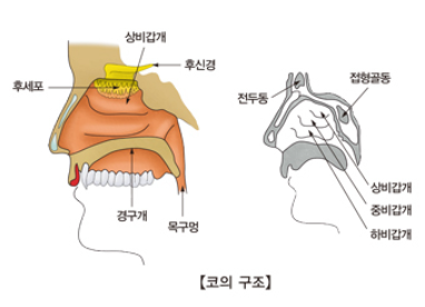 비염치료방법