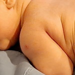 신생아 BCG접종 피내용vs경피용 목욕과 고름 흉터관리는 어떻게 할까요?