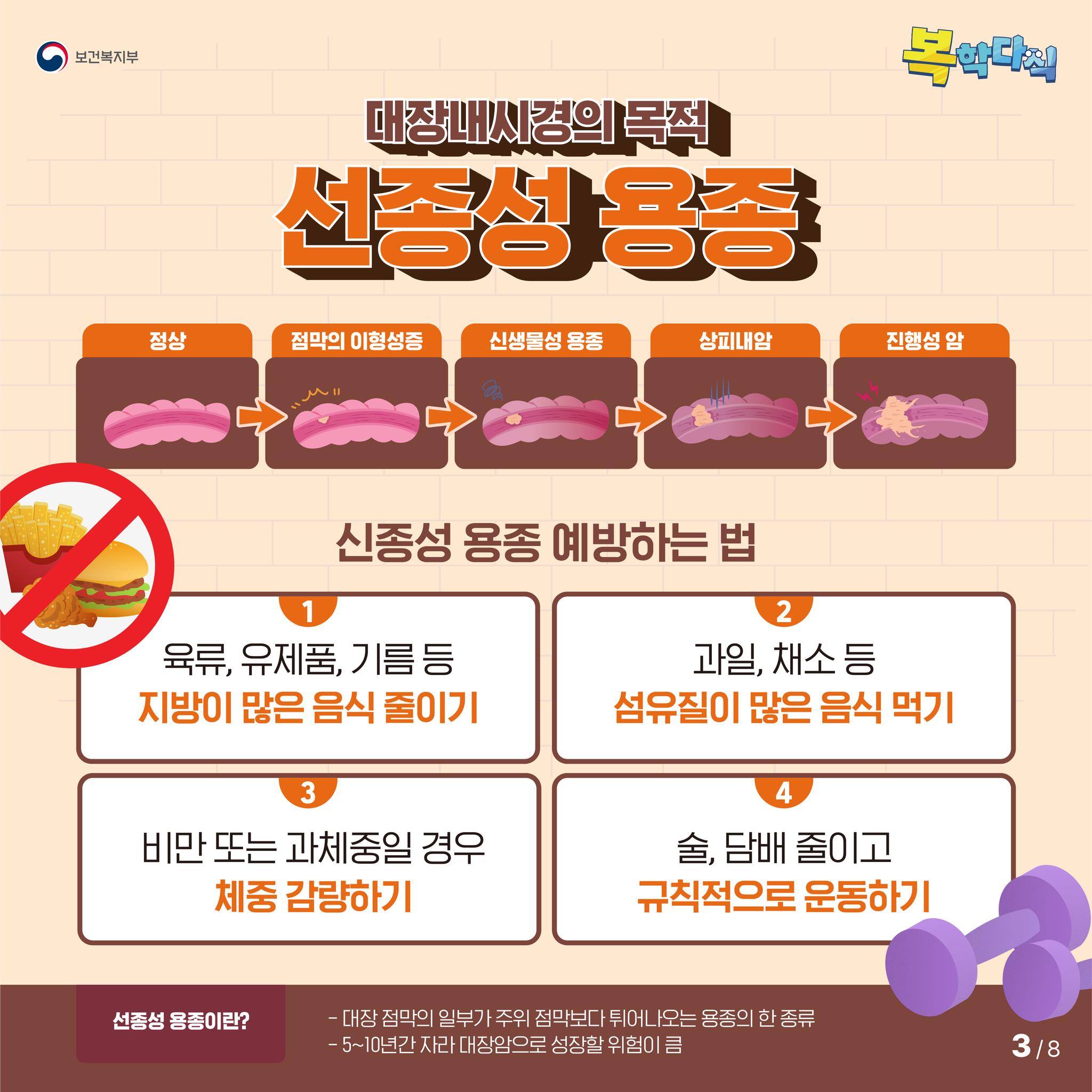 대장암 증상 : 1~3기 단계별 증상 총정리