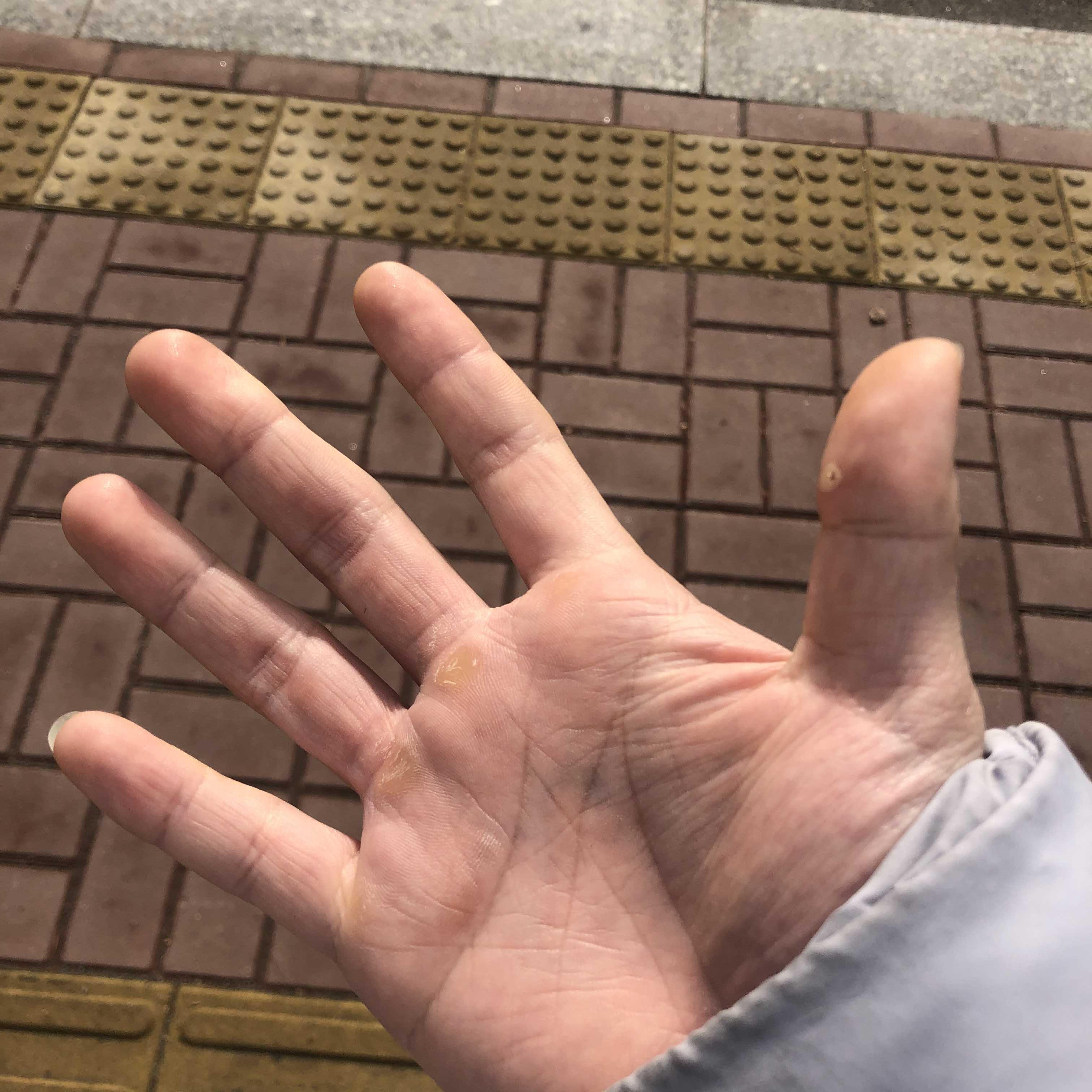 손