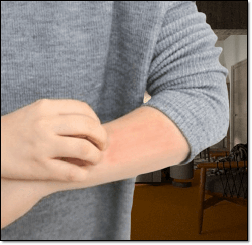 알레르기가 있는 남성