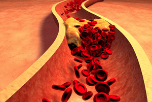 고지혈증에 좋은 음식03