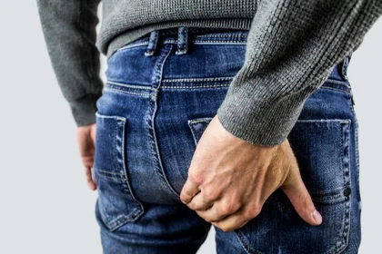 치질 증상과 약·자가치료·수술 비용까지 정리3