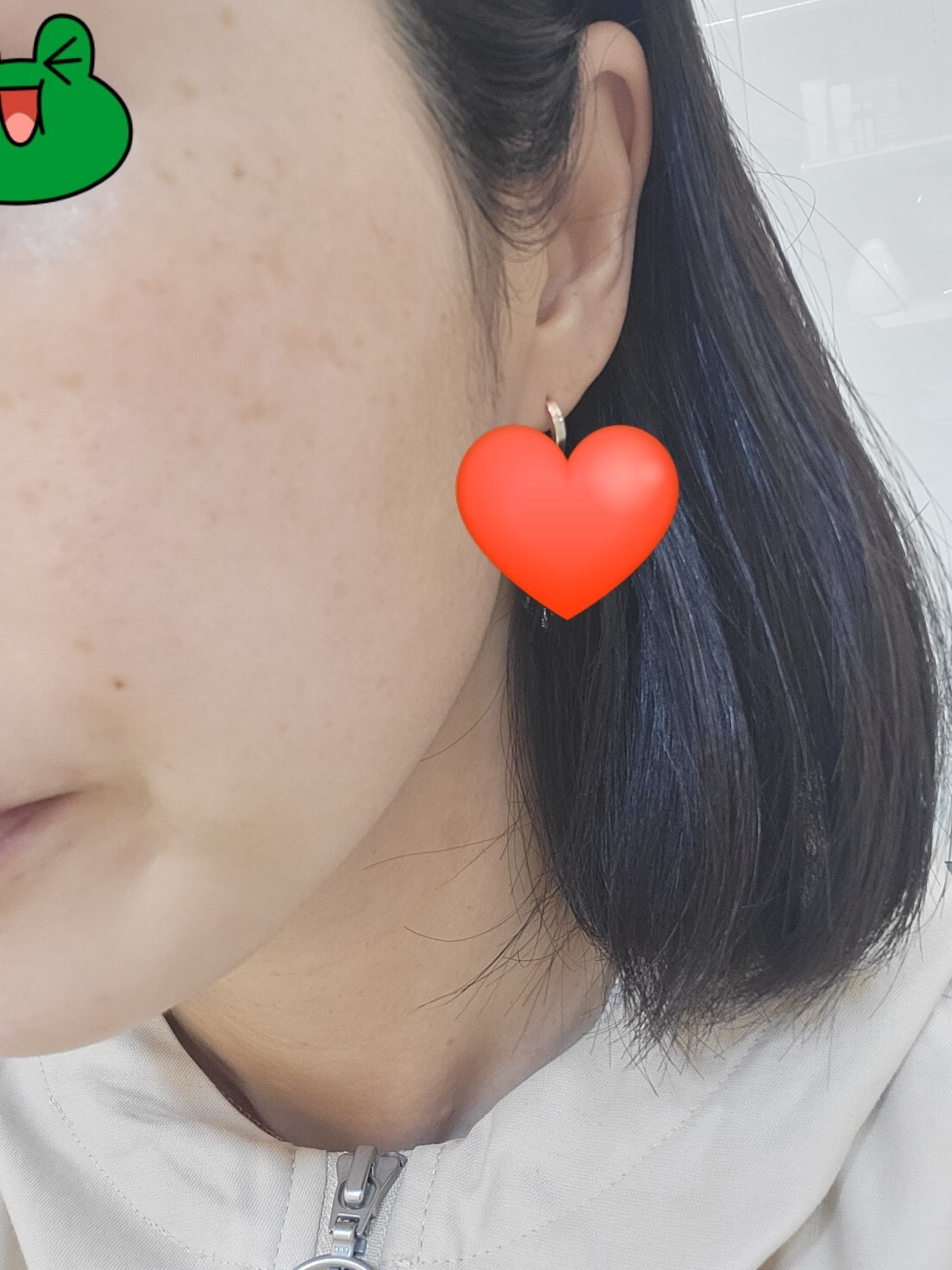 흑자레이저 후기