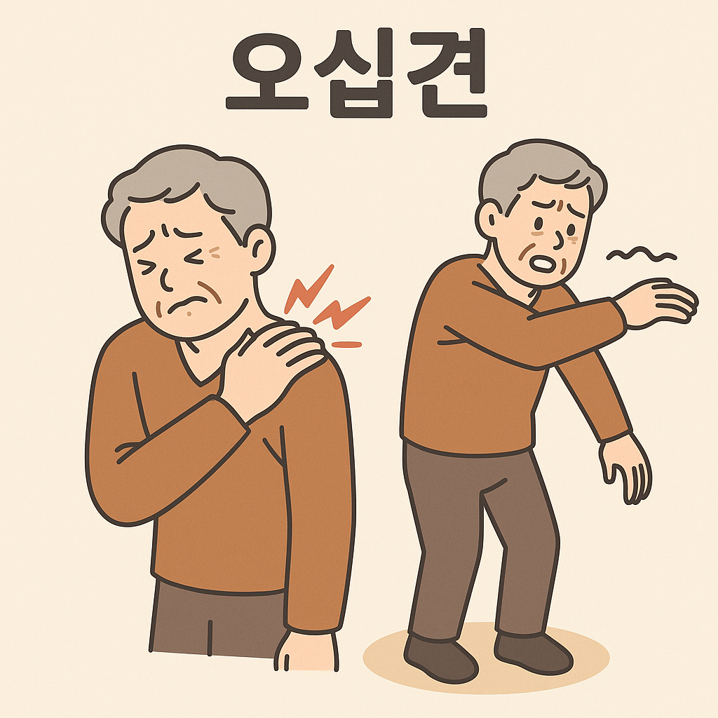 오십견 원인