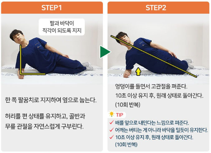 사이드브릿지