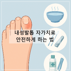내성발톱 자가치료 안전하게 하는 법 썸네일