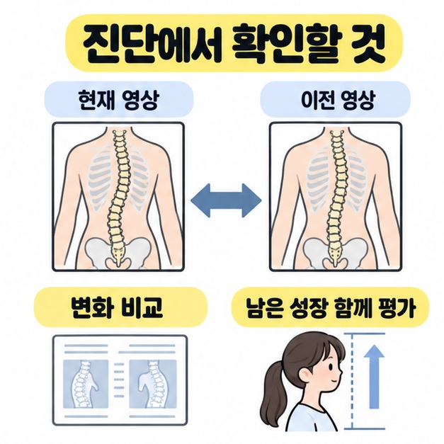 현재 영상과 이전 영상의 척추 그림을 양방향 화살표로 비교하고 검사 자료와 키 성장 그림으로 변화 비교와 남은 성장 평가를 안내한 그림