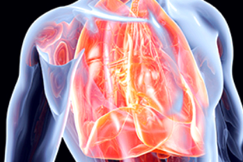 동맥경화증 초기증상