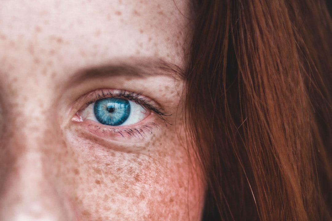 Under-eye.