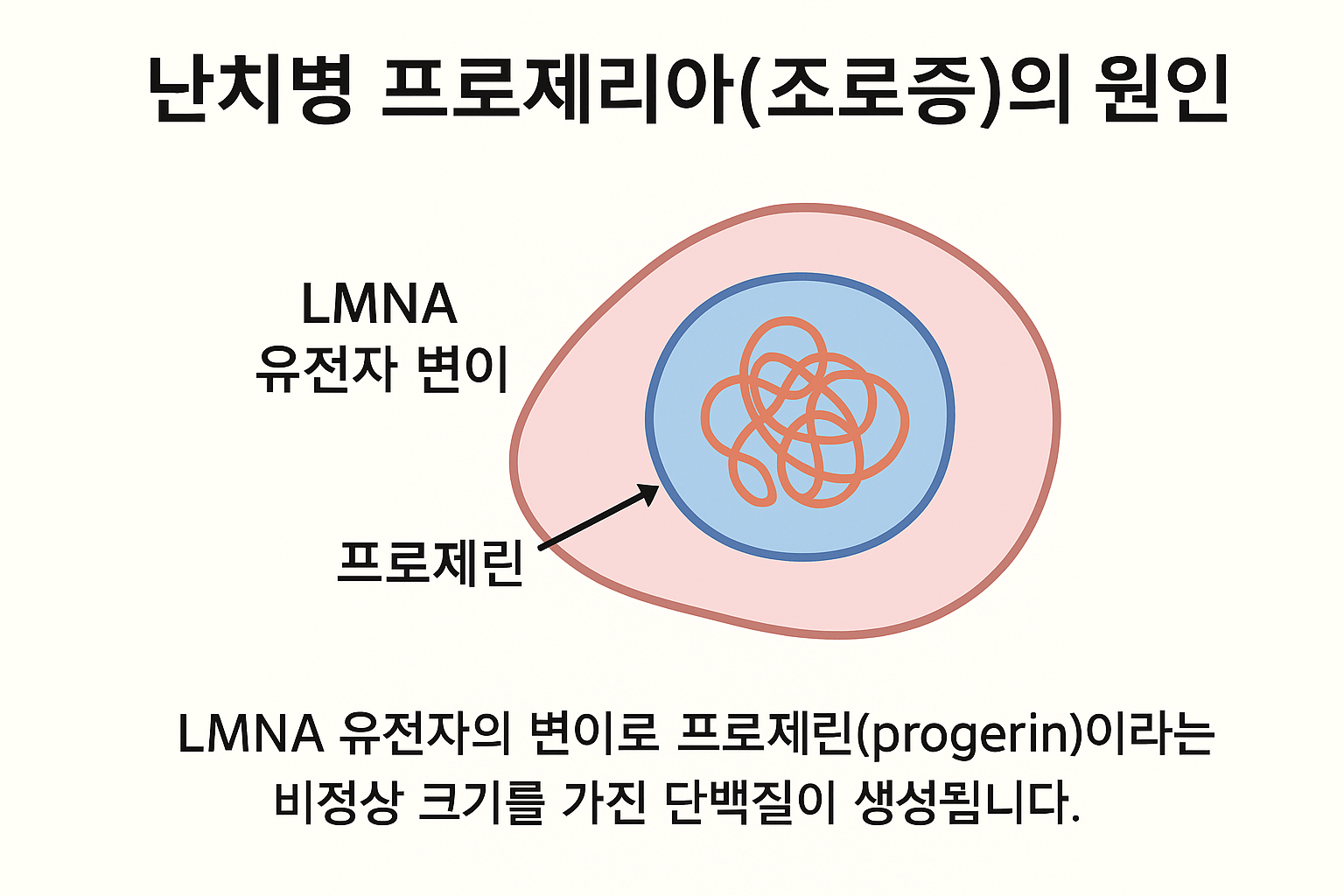 프로제리아(조로증)