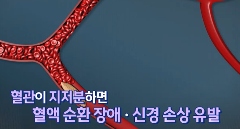 대마종자유 효능