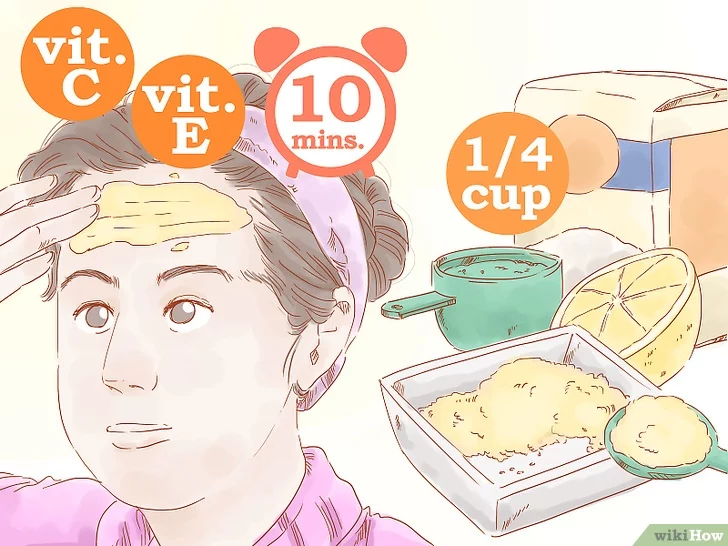 이마주름 없애기