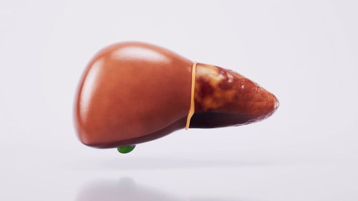 지방간 진행 사진