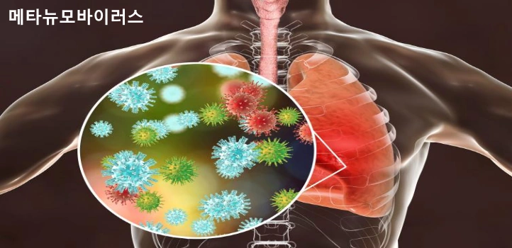 메타뉴모바이러스 