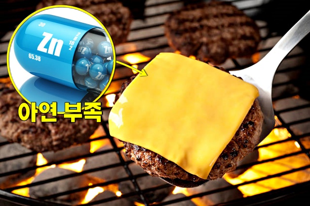 비듬이 생기는 원인 5가지 아연 부족 증상 비티만b 부족증상, 건강 팁줌 매일꿀정보