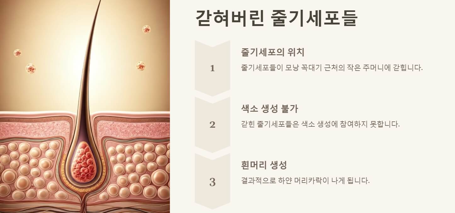 흰머리 나는 이유