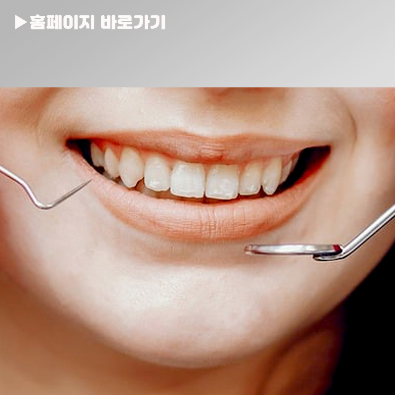 누렁니 치아미백