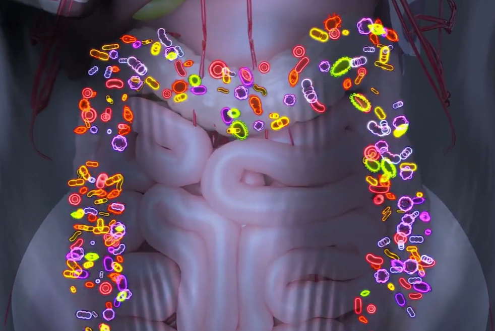 장누수증후군 증상