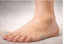 발바닥통증의 원인