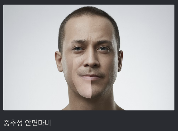안면마비-전조증상과-차이점-사람-안면마비-얼굴-모습