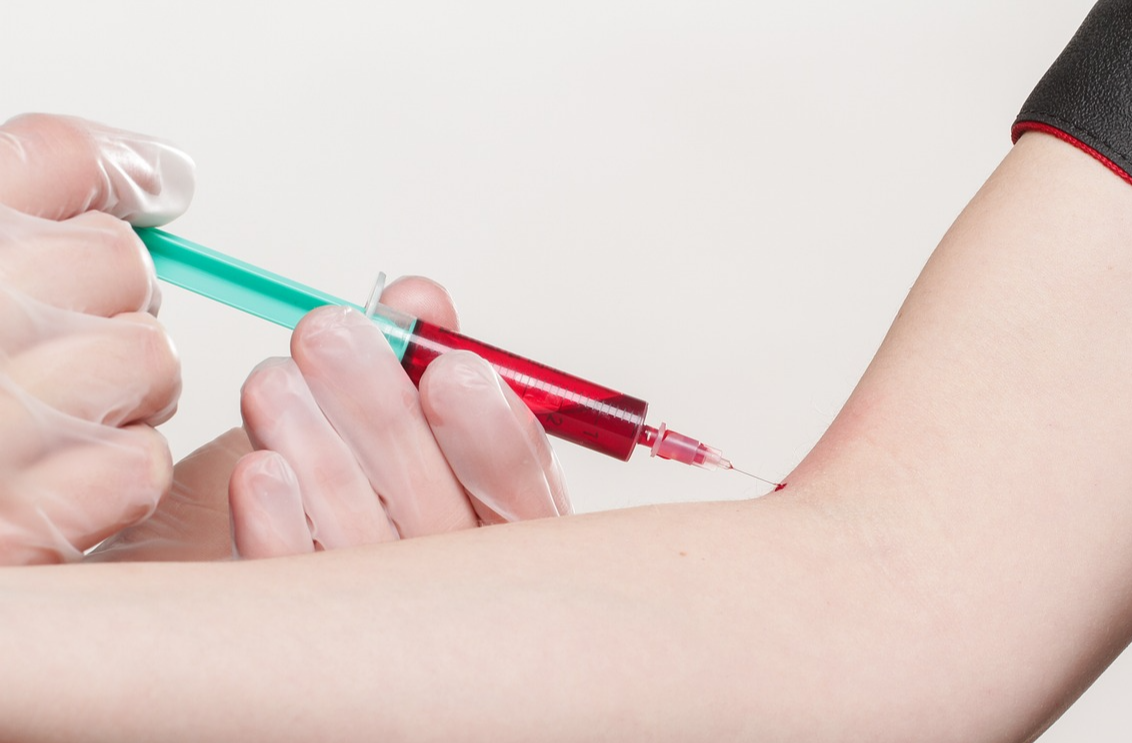 혈액을 채취하는 모습