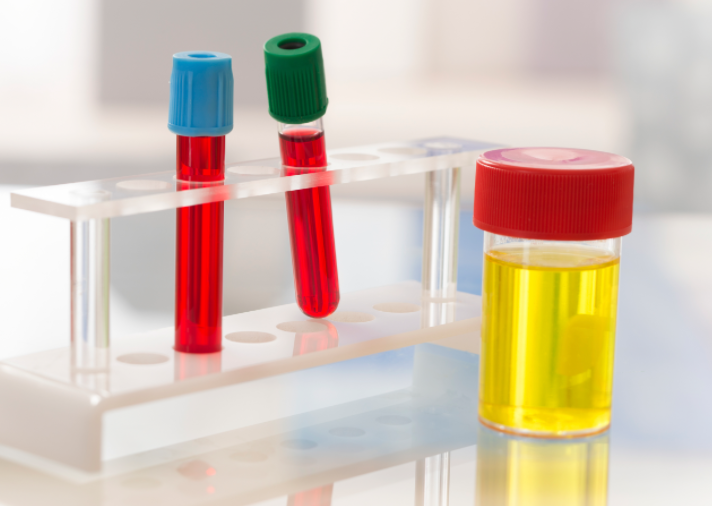 STD 12종 성병 검사