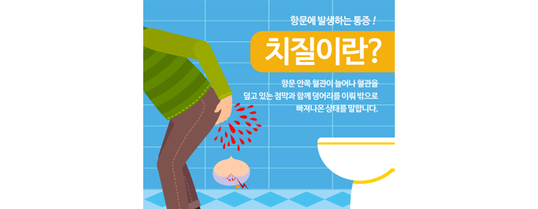 대전 유성구 항문외과