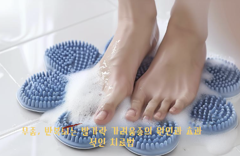 무좀, 반복되는 발가락 가려움증의 원인과 효과적인 치료법