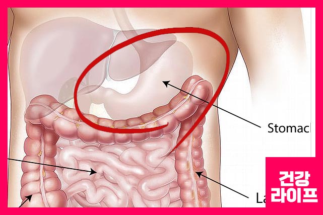 식도 부위 중 대식도 괄약근에 문제가 생기면 위산이 역류가 원인