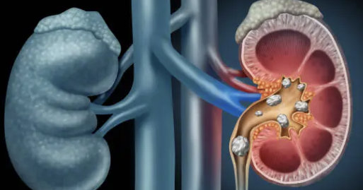 왼쪽 아랫배 통증 18