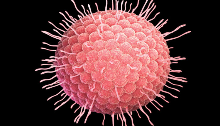 수두대상포진바이러스